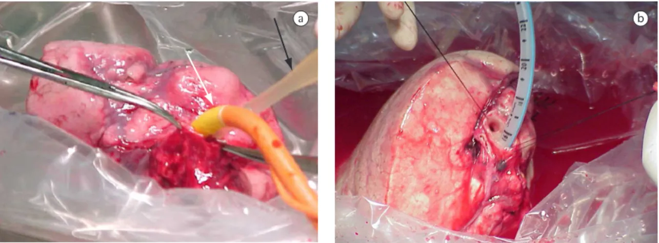 Figure 2 - a) Initiation of the perfusion with saline solution in the lobar artery (black arrow) and ventilation of the left  lower lobe of the donor (white arrow)