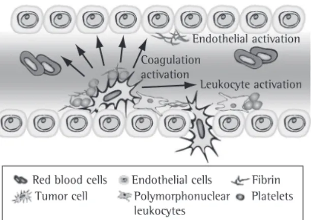 Figure  2  -  Tumor  cell  interactions  in  the  vascular  bed.  Tumor  cells  adhered  to  the  vascular  endothelium,  activating  platelets,  polymorphonuclear  leukocytes  and  the  endothelium  itself
