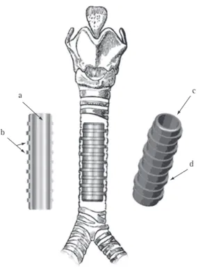 Figure 1 - Principal features of the HCPA-1 silicone stent: 