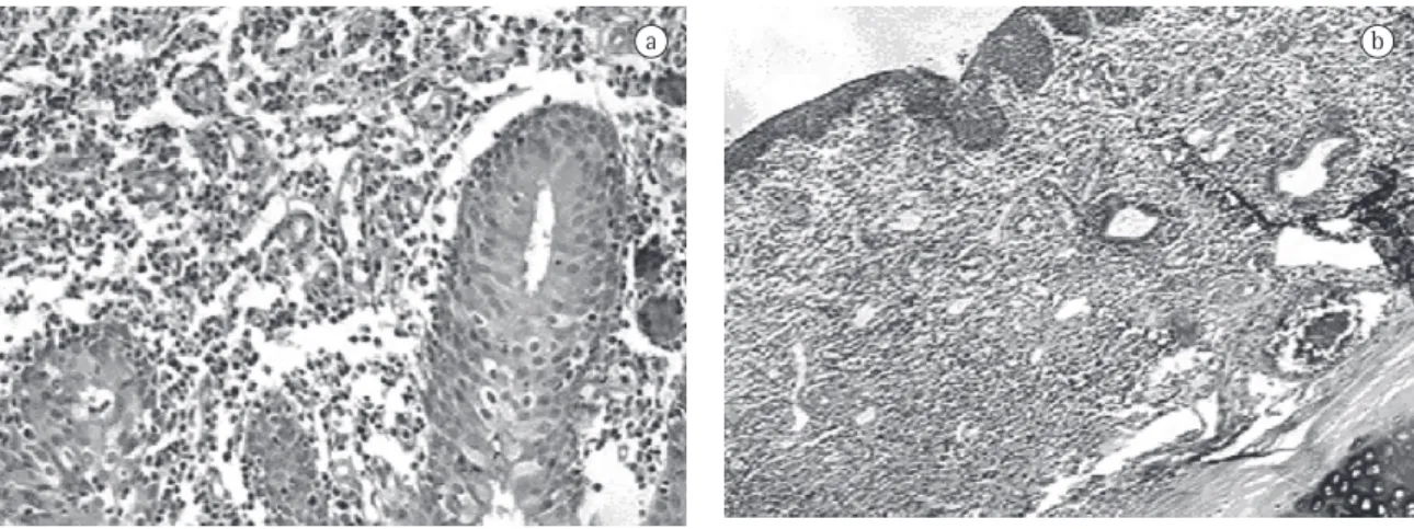 Figure 5 - Results at six weeks after implantation: the inner surface of the trachea is well-preserved and in contact  with the HCPA-1 stent; a) the basal epithelial membrane is intact at 100 ×  magnification; and b) although a discrete  submucosal inflamm