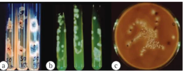 Figure 2 - a) Culture on 2% Sabouraud-glucose agar  at  different  incubation  periods,  showing  inhibition  of bacterial growth starting at 40°C, associated with  thermal tolerance of  Aspergillus fumigatus ; b) Culture  on  2%  Sabouraud-glucose  agar  