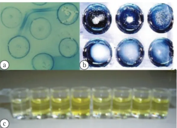 Figure  4  -  a)  Lines  of  identity  observed  in  positive  immunodiffusion  test  for  paracoccidioidomycosis; 