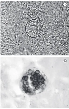 Figure  1  -  a)  sputum  smear  microscopy  (10% 