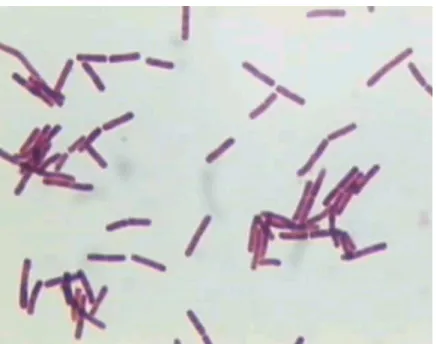 FIGURA 2 - Coloração de Gram de Clostridium botulinum tipo D, obtida a 