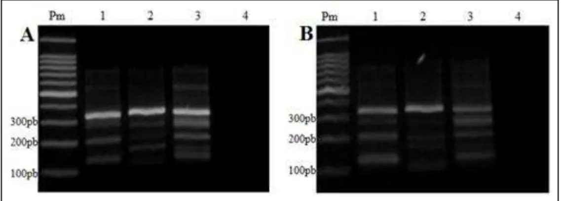 Figura  10  –  Produtos  da  técnica  de  Tetraprimer  ARMS-PCR  proveniente  de  uma  primeira  reação  apresentados  em  géis  de  agarose  2%