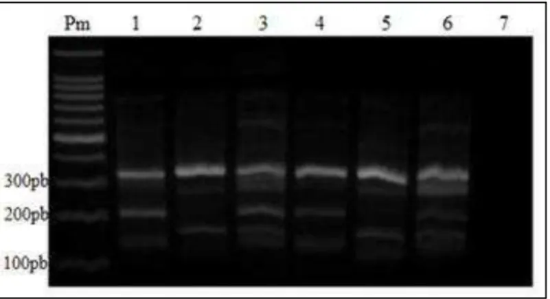 Figura  13  –  Produtos  da  Tetraprimer  ARMS-PCR  utilizando  DNA  genômico,  apresentados  em  gel  de  agarose  2%