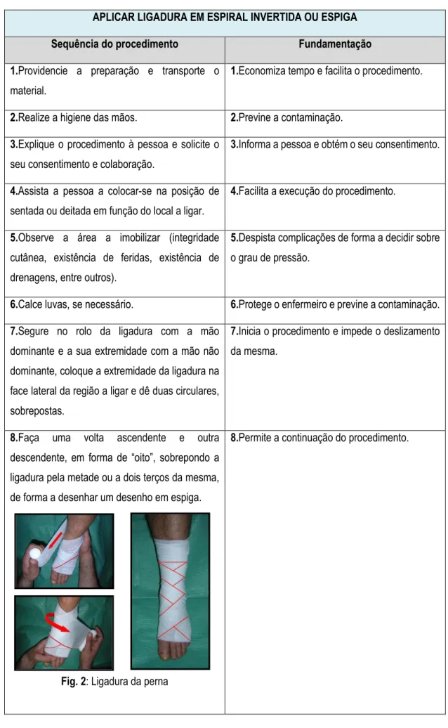Fig. 2: Ligadura da perna 