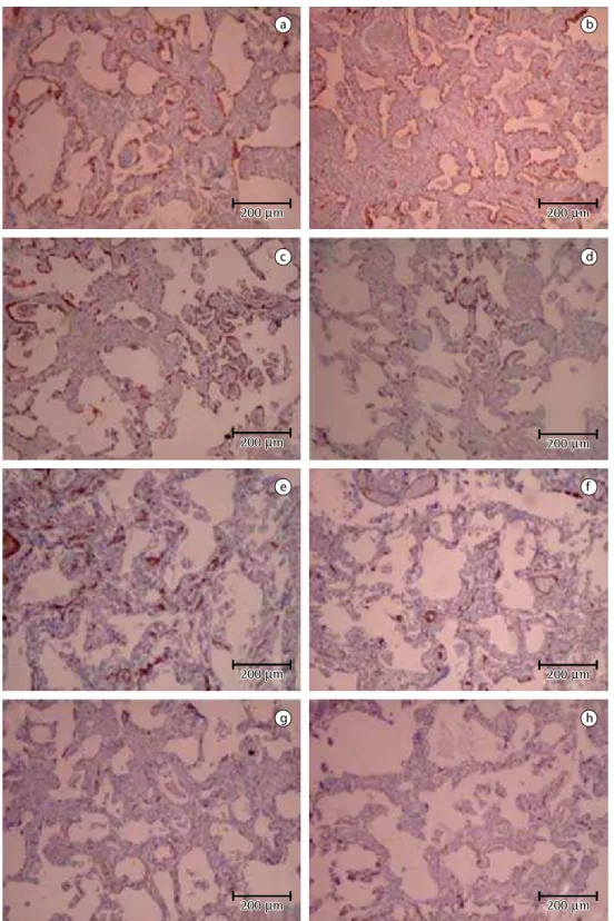 Figure  1  -  Histologic  representation  of  idiopathic  NSIP  and  SSc-NSIP.  Immunoexpression  of  CK7  in  the  continuous basement membrane in idiopathic NSIP (a) and SSc-NSIP (b)