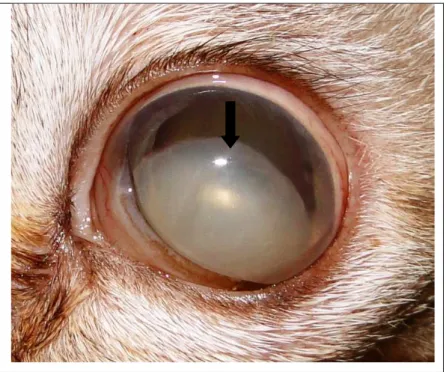 Figura 09. Fotografia de olho de gato com luxação anterior do cristalino (seta). 