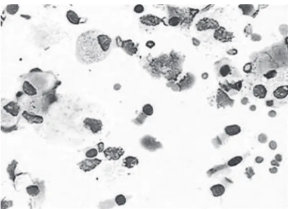 Figure 1 - Ciliated epithelial cells.