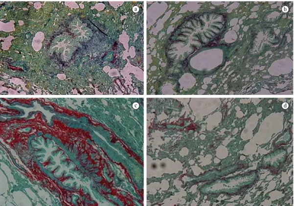 Figure 1 - Photomicrographs of the lung tissue of rats. In a), sample obtained from a control rat; in b), sample  obtained  from  a  rat  without  diabetes  mellitus  but  treated  with  superoxide  dismutase  (SOD);  in  c),  sample  obtained from a rat w