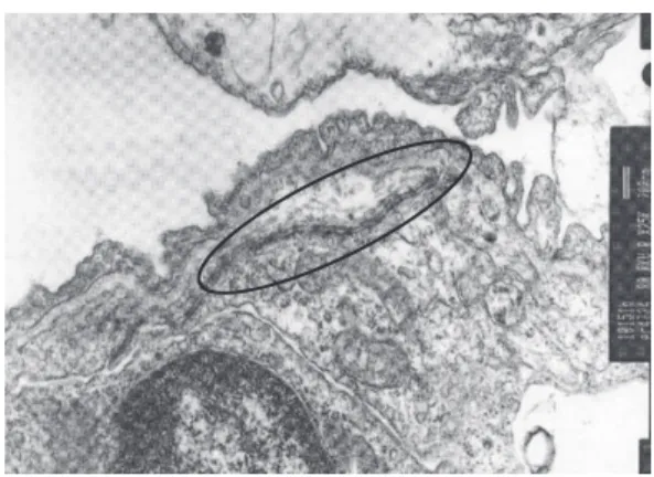 Figure 1 - Electron micrograph showing the alveolar  septum of a rat ventilated for 4 h with tidal volume  of  8  mL/kg