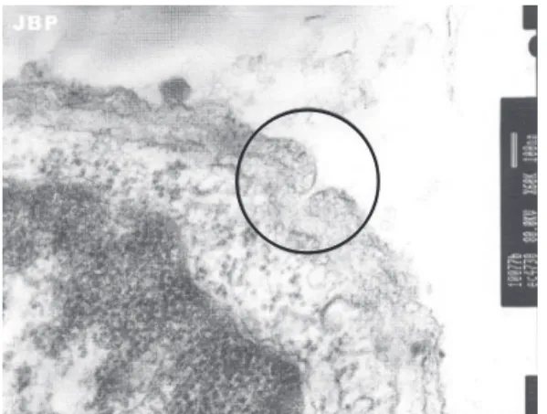 Figure 4 - Electron micrograph showing the alveolar  septum of a rat ventilated for 4 h with tidal volume  of 24 mL/kg
