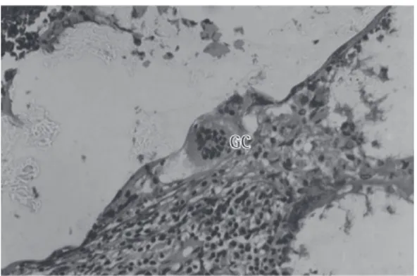 Figure 4 - Typical histopathological sample of lung  tissue in the suture, large fragment (SuLF) group