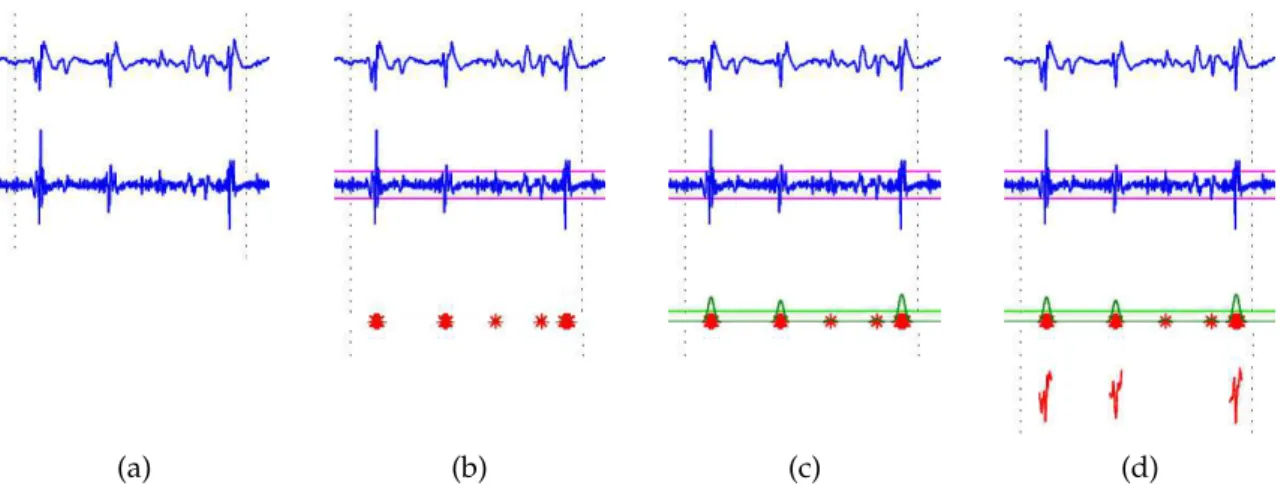 Figura 4.2: Algoritmo de detecção automática. (a): sinal+derivada, (b): limiar de detecção, (c): densidade de detecções, (d): potenciais extraídos do sinal.