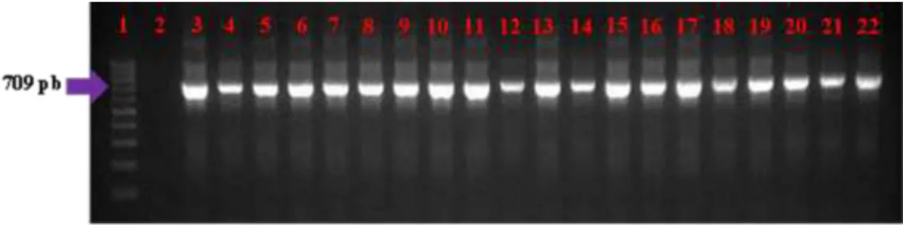 Figura  3:  Amplificação  do  gene  GAPDH  do  DNA  das  amostras  extraídas  da  camada  leucocitária  de 