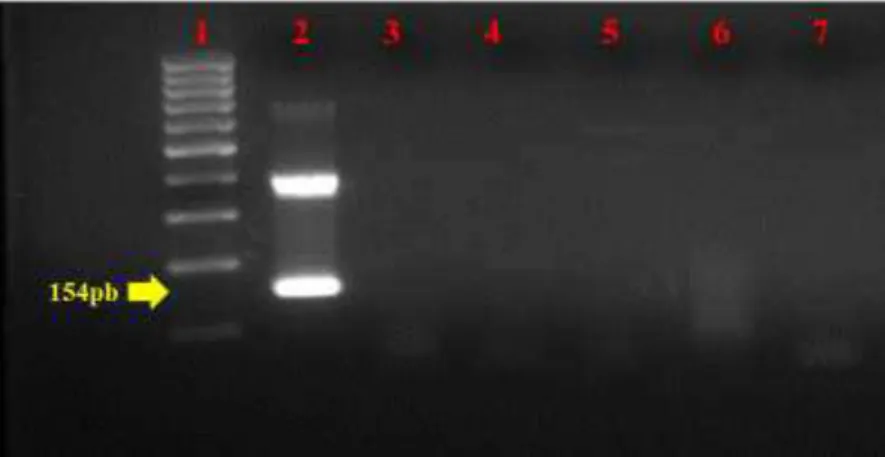 Figura  5:  Eletroforese  em  gel  de  agarose  1,5%  apresentando  a  especificidade dos iniciadores utilizados na PCR-SN