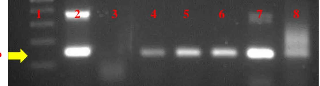 Figura 7: Gel de agorose 1,5% mostrando a amplificação do gene pol através da PCR-SN. 