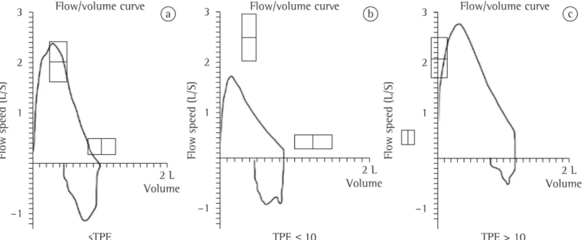 Figure 1 - Flow-volume curves, in accordance with the acceptability criteria for each group