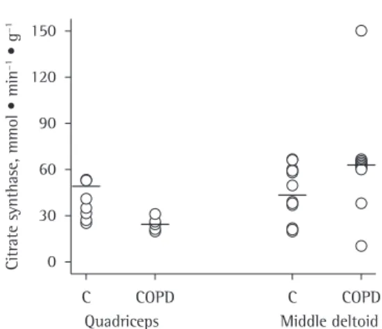 Figure 1 - Comparison between patients with COPD  and controls (C) regarding the levels of the oxidative  enzyme citrate synthase in the quadriceps and middle  deltoid