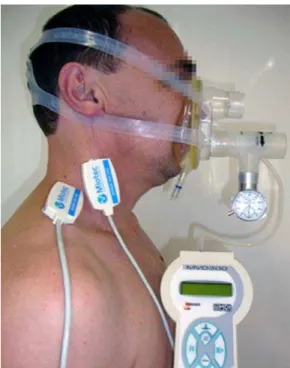 Figure 1 - Use of expiratory positive airway pressure  (EPAP) in a volunteer. During the use of EPAP, the  electromyographic activity of the sternocleidomastoid  and scalene muscles was recorded simultaneously  with tidal volume and mask pressure (with a v