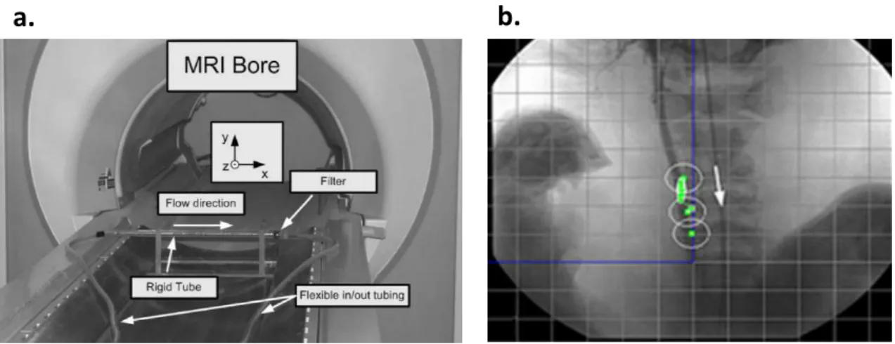 Figure 3.4 a) Preliminary experimental setup installed inside a 1.5T Siemens Magnetom Vision MRI bore  [43]; b) In vivo automatic navigation of a 1.5-mm ferromagnetic bead inside the carotid artery of a living  swine