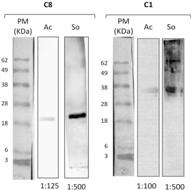 Figura 10: Western Blot usando as proteínas recombinantes e os anticorpos de coelhos imunizados com  cada uma, revelado por anti-IgG de coelho conjugado com peroxidase na diluição de 1:20000