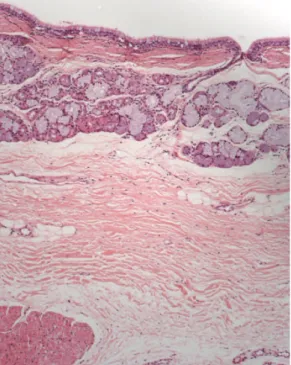 Figure 4 - Histological image of the posterior wall.