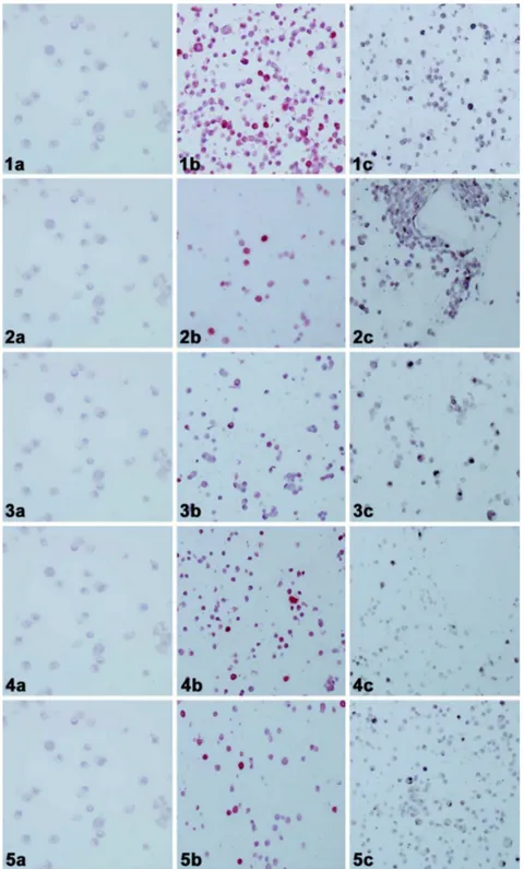 Figura  1.  Fibroblastos  de  embriões  de  galinha  DF-1  experimentalmente  infectados  com  variantes do VRE