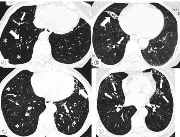 Figure 1 - Axial HRCT scans of the chest (lung window) at the level of the lower lung fields
