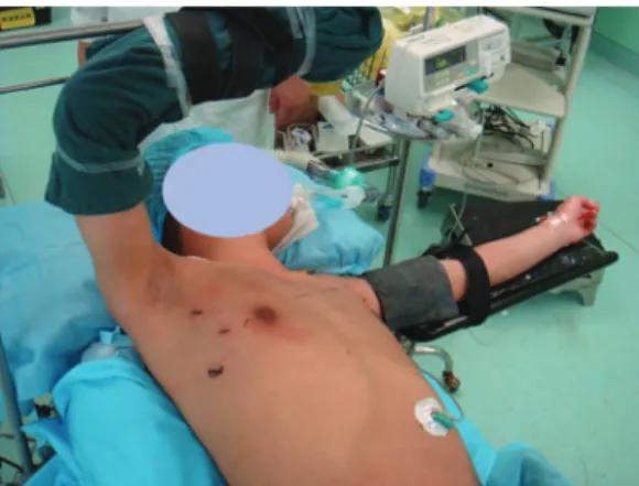 Figure 2 - Intraoperative patient position.