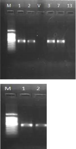 Figura  1:  Eletroforese  em  gel  de  agarose  1%  do  produto  de  amplificação  por  PCR  dos  fragmentos dos rDNA 16S de bactérias de fezes de cães