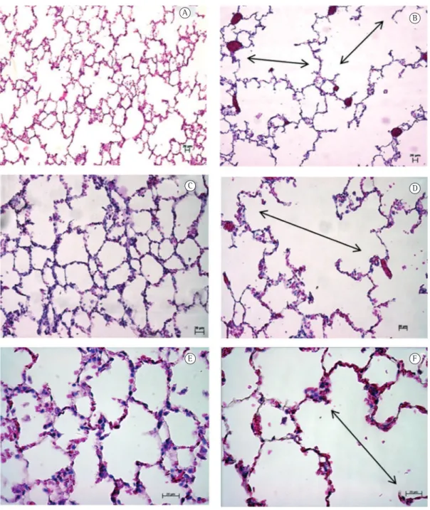 Figure 4 - Photomicrographs of rat lung tissue stained with H&amp;E (magnification: ×100 [A and B]; ×200 [C  and D]; and ×400 [E and F])