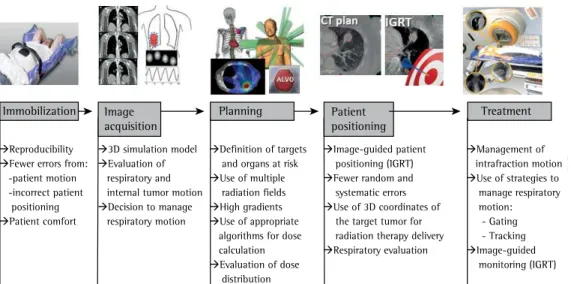 Figure 1 - Description of the steps involved in stereotactic body radiation therapy. IGRT: image-guided  radiotherapy