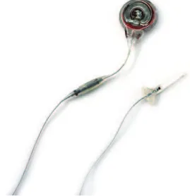 Figure 1 - Diaphragmatic pacemaker with the receiver  connected to the electrode.
