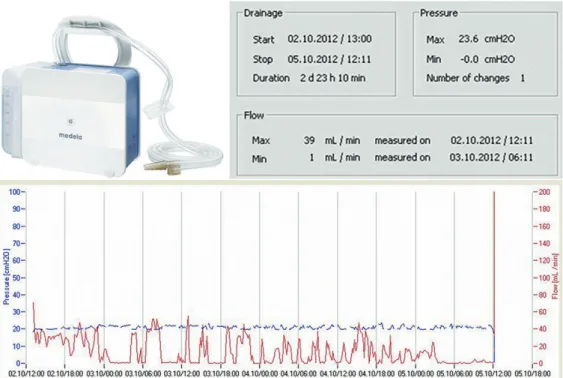 Figure 1. In the upper left, a picture of the digital device used. In the upper right and at the bottom, computer-generated  data and a computer-generated graph, respectively