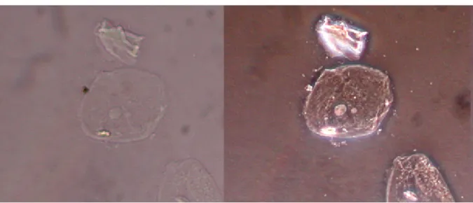 Figure 2.1 Comparison between a brightfield and a phase contrast image of the same cell.