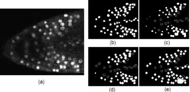 Figure 5.1 Segmentation results for the baseline methods applied to the problem of in vivo cell nuclei detection: (a) input image of the Arabidopsis thaliana plants root tip, (b) expert hand annotation, (c) Otsu thresholding, (d) level sets segmentation an