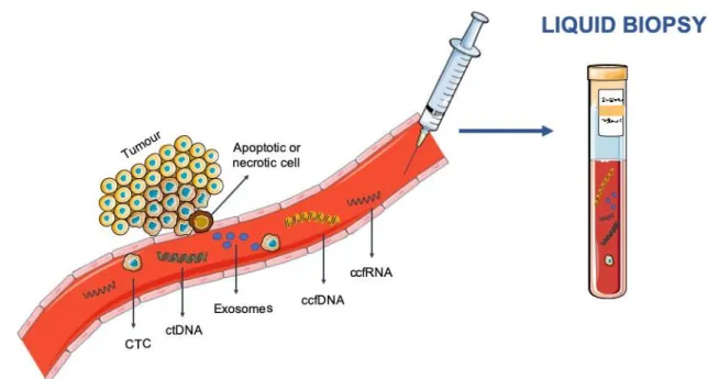 Figure  1.  Blood-based  liquid  biopsy.  Circulating  tumour  cells  (CTC),  circulating  cell-free  DNA  (ccfDNA)  [including  circulating  tumour  DNA  (ctDNA)],  circulating  cell-free  RNA  (ccfRNA)  and  exosomes are released from tumour cells to the