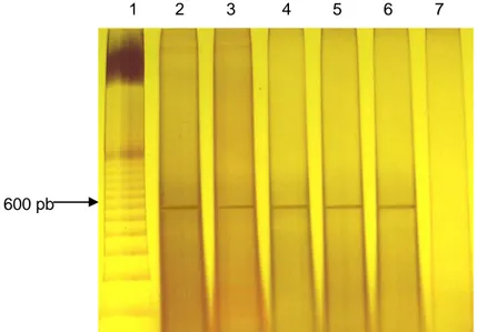 Figura  5:  Análise  do  gel  de  poliacrilamida  6%  corado  pela  prata  contendo  os  produtos  da  RT/PCR (segmento do gene VP1 do IBDV (588 pb)) obtidos das amostras testadas