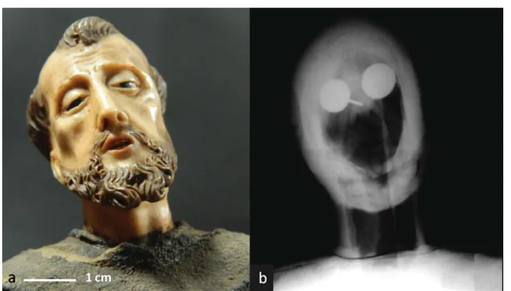 Fig. 8 St. Francis' head front view, from ﬁ gurine E658: (a) macrograph under visible illumination in direct light; (b) enlargement of the X-ray image obtained at 40 kV, 6 mA, 300 s and 2 m (object – X-ray source distance) – scale bar: 1 cm.