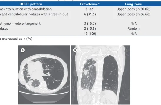 Table 1. HRCT pattern and distribution of indings by lung zone.