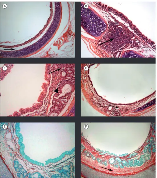Figure 2. Photomicrographs of tracheal sections from animals in the different groups studied (H&amp;E and picrosirius  red; magniication, ×100)