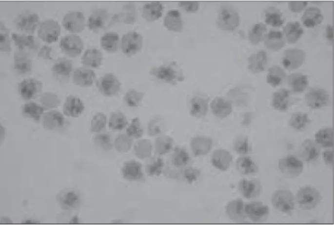 Figure 2  – Erythrocytes with precipitates of Heinz bodies. Source: LM SL