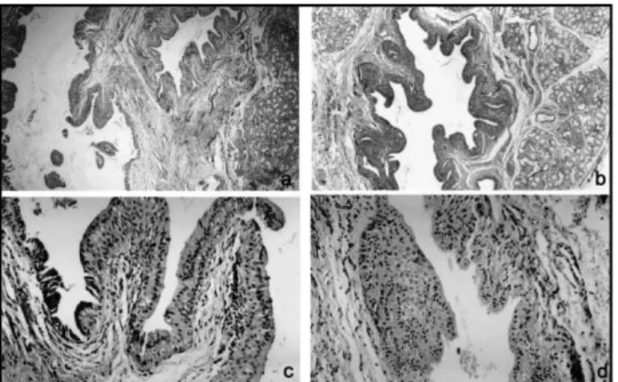 Figure 1 – A: Microcysts and well differentiated mucous acini (H&amp;Ex40); B: cystic cavity  exhibiting  papillary  projections  supported  by  fibrous  connective  tissue  (H&amp;E  x100); 