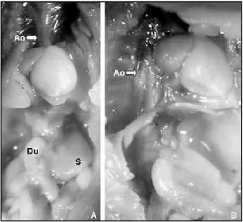 Figure 6 – Photograph of the autopsy of a group E fetus. Note the severe hypoplasia of  the pulmonary artery (PA) compared to the aorta in A