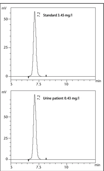 Figure  –  Chromatograms of  δ -aminolevulinic acid in standard solution (3.45 mg/l)  and urine from a patient (0.43 mg/l) eluted near 7 minutes 