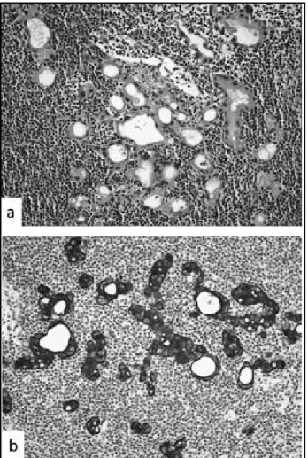 Table 1 Tumor features