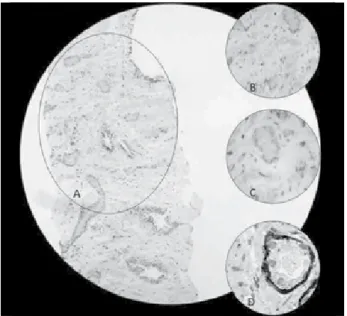 Figure 4 – ASAP