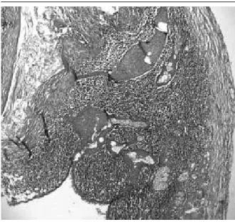 FIGURE 4 –  Pancreatic dermoid cyst (HE 20×): closer view of Figure 3 HE: hematoxylin and eosin.